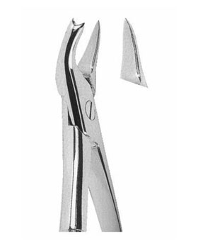 <span>Upper Molars Left </span>